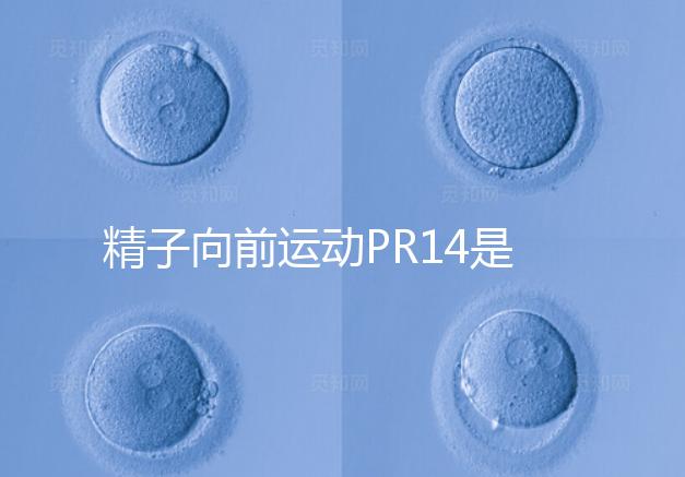 精子向前運動PR14是否正常聽專家怎么說，當心弱精找上門