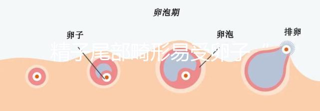 精子尾部畸形易受卵子“嫌棄”，無(wú)尾、短卷尾需重視