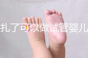 結扎了可以做試管嬰兒嗎（女性結扎了可以做試管嬰兒嗎）