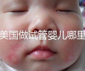 去美國做試管嬰兒哪里最好,4家好評輔助生殖機(jī)構(gòu)推薦