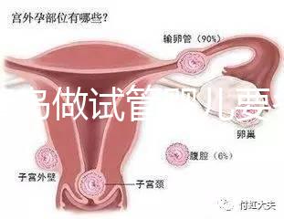 去青島做試管嬰兒要多少錢(qián)?