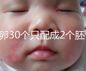 取卵30個只配成2個胚胎別放棄！卵巢傷口小移植成功率不低