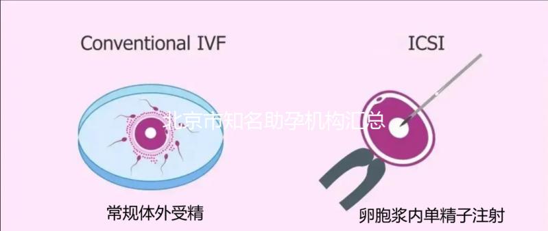 北京市知名助孕機構(gòu)匯總,成功率多少一看便知!