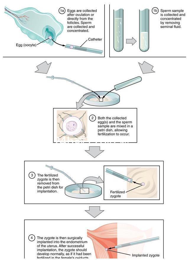 事后24h或72h吃避孕藥有效率真不高，一不小心容易中招