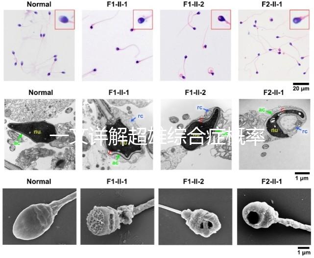 一文詳解超雄綜合癥概率有多大，想造的人多不多看過來