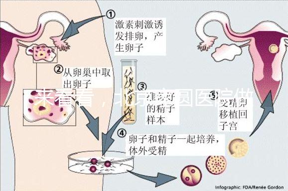 來(lái)看看，北京家圓醫(yī)院做三代試管費(fèi)用總共多少？
