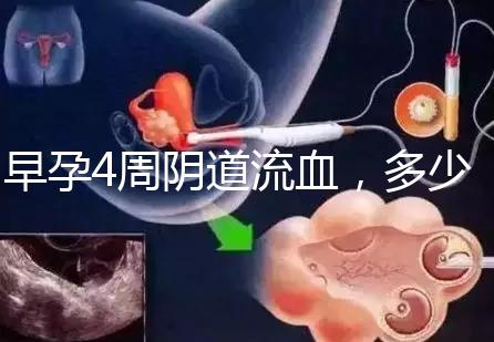 早孕4周陰道流血，多少天檢查血hcg或B超更穩(wěn)妥？