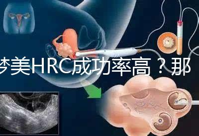 夢美HRC成功率高？那是因為有這些試管嬰兒醫(yī)生