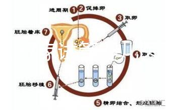 浙江27家試管嬰兒醫院成功率排名公開，邵逸夫醫院位居前十