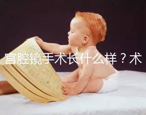 宮腔鏡手術(shù)長什么樣?術(shù)后要注意什么? ?