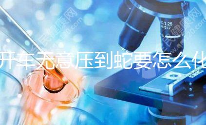 開車無意壓到蛇要怎么化解進來瞧，要不要報警一目了然