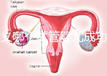 遵義哪個試管嬰兒成功率高？貴州生殖中心醫(yī)院2024年排名參考