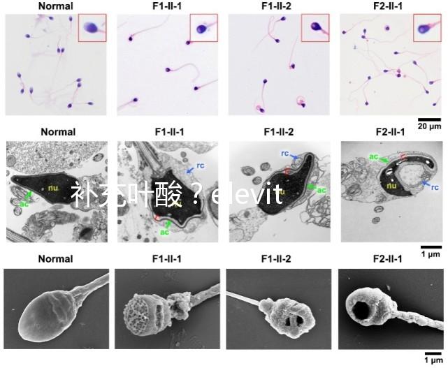 補充葉酸？elevit愛樂維那你不得不了解