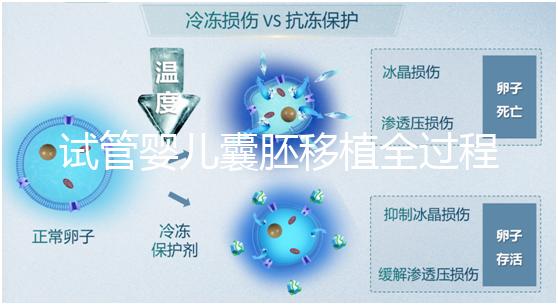 試管嬰兒囊胚移植全過(guò)程揭秘