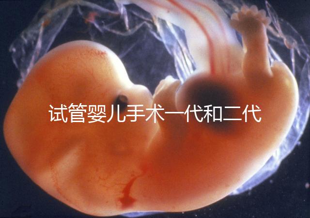 試管嬰兒手術一代和二代有哪些區別？