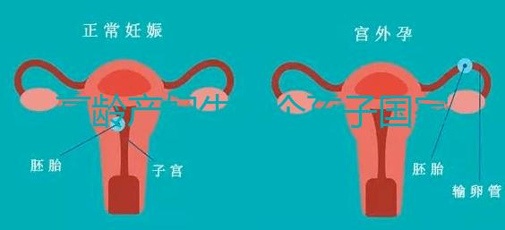 高齡產婦生八個孩子國家有補助？有沒有違法才是關鍵