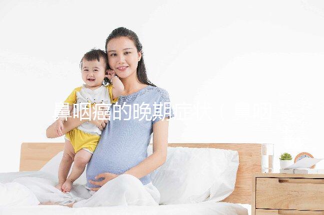 鼻咽癌的晚期癥狀(鼻咽癌的晚期癥狀表現有哪些)