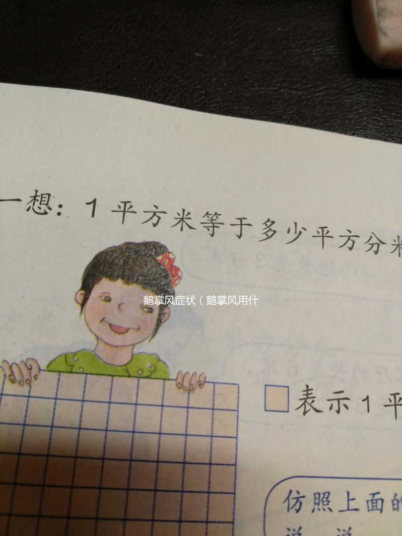 鵝掌風癥狀（鵝掌風用什么藥根治）