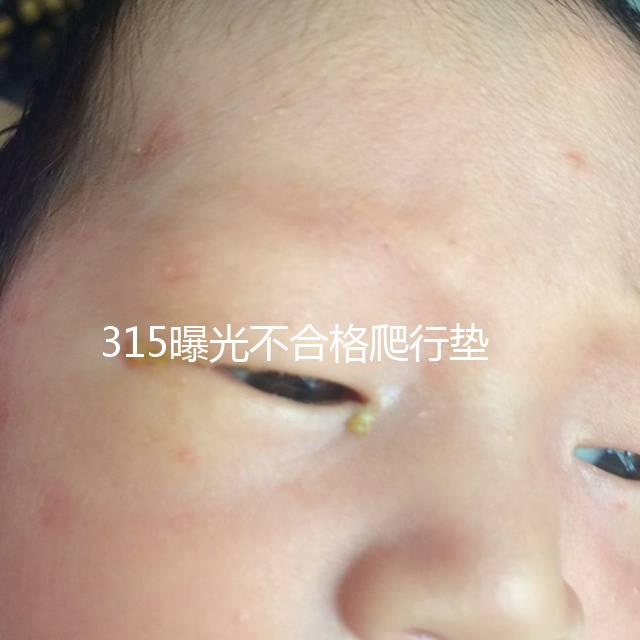 315曝光不合格爬行墊品牌，甲酰胺超標的危害可不小