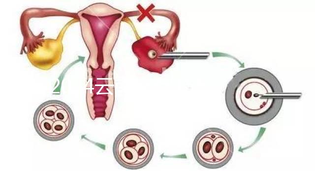 2024云南產假158天怎么算？新政策中，男方培育假貨