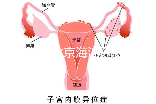 2024年北京海淀區新生兒醫療保險處理策略，照片要求不要出錯