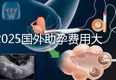 2025國(guó)外助孕費(fèi)用大公開:?jiǎn)紊砣耸抠M(fèi)用對(duì)比與機(jī)構(gòu)推薦