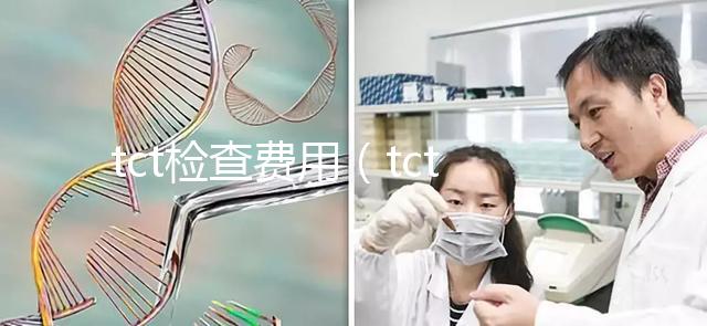 tct檢查費用（tct檢查一般多少錢）